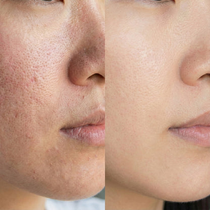 DIE ULTIMATIVE REGENDUSCHE